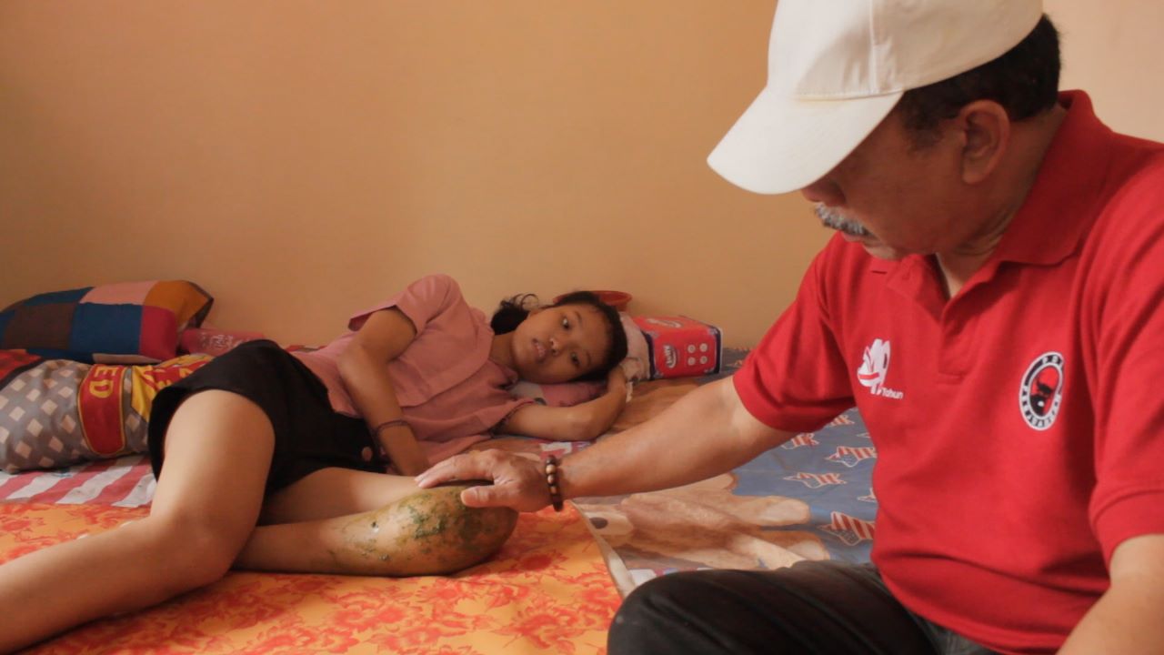 BMI Peduli, Sasar Penderita Kanker Tulang